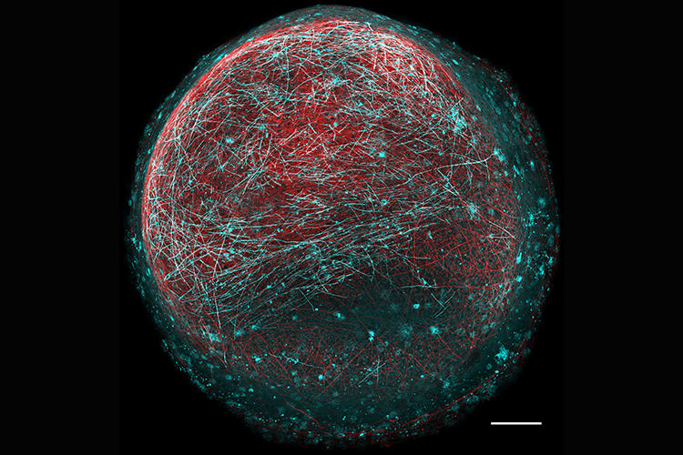 An organoid - a sphere of red nerve wires being wrapped around in specialised blue myelin insulation 