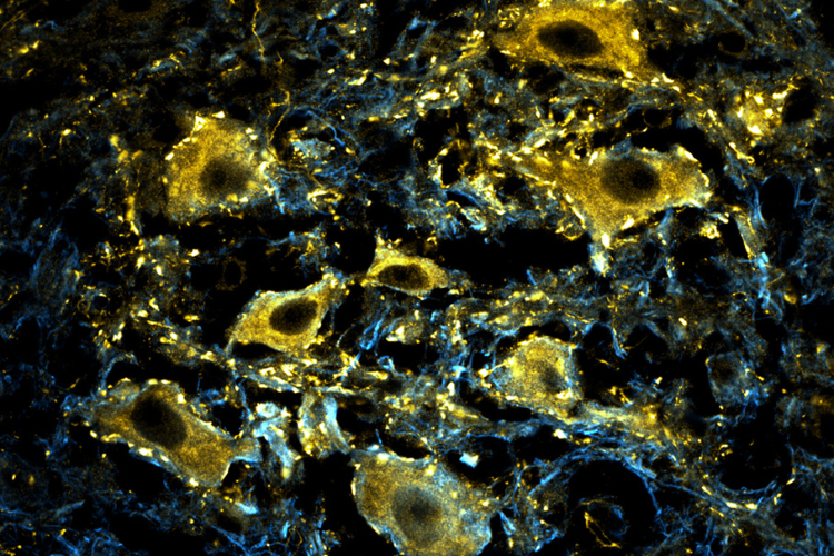 Stunning microscope image of neurons labelled gold