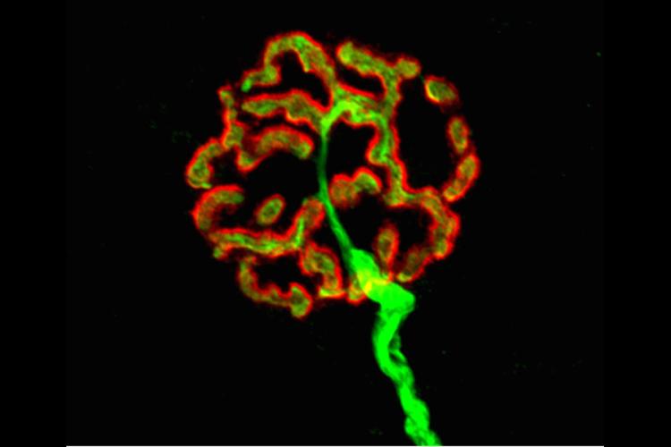 A green and red high magnification microscope image of the junction between a motor neuron and a muscle