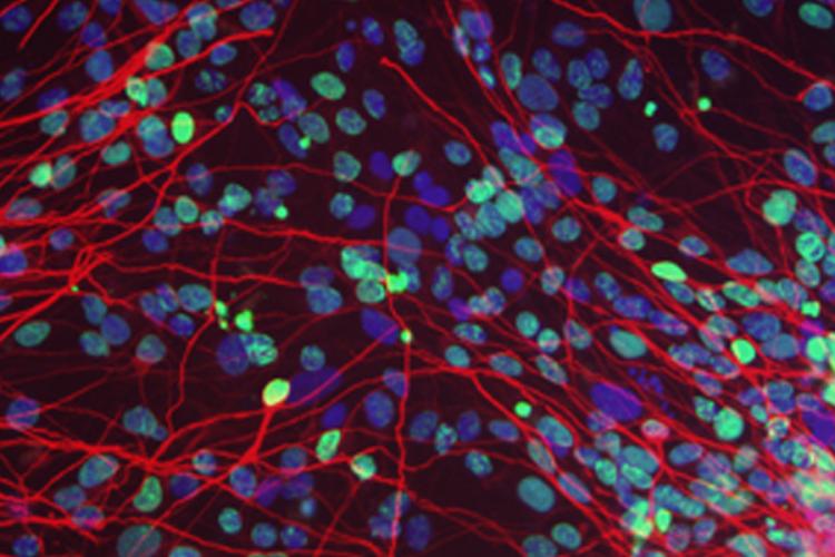 High magnification microscope image of brain cells growing in a dish in the lab, with different parts of the cells shown in different bright colours