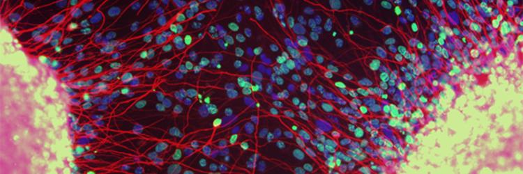 High magnification microscope image of brain cells growing in a dish in the lab, with different parts of the cells shown in different bright colours
