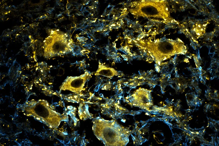 Stunning microscope image of neurons labelled gold
